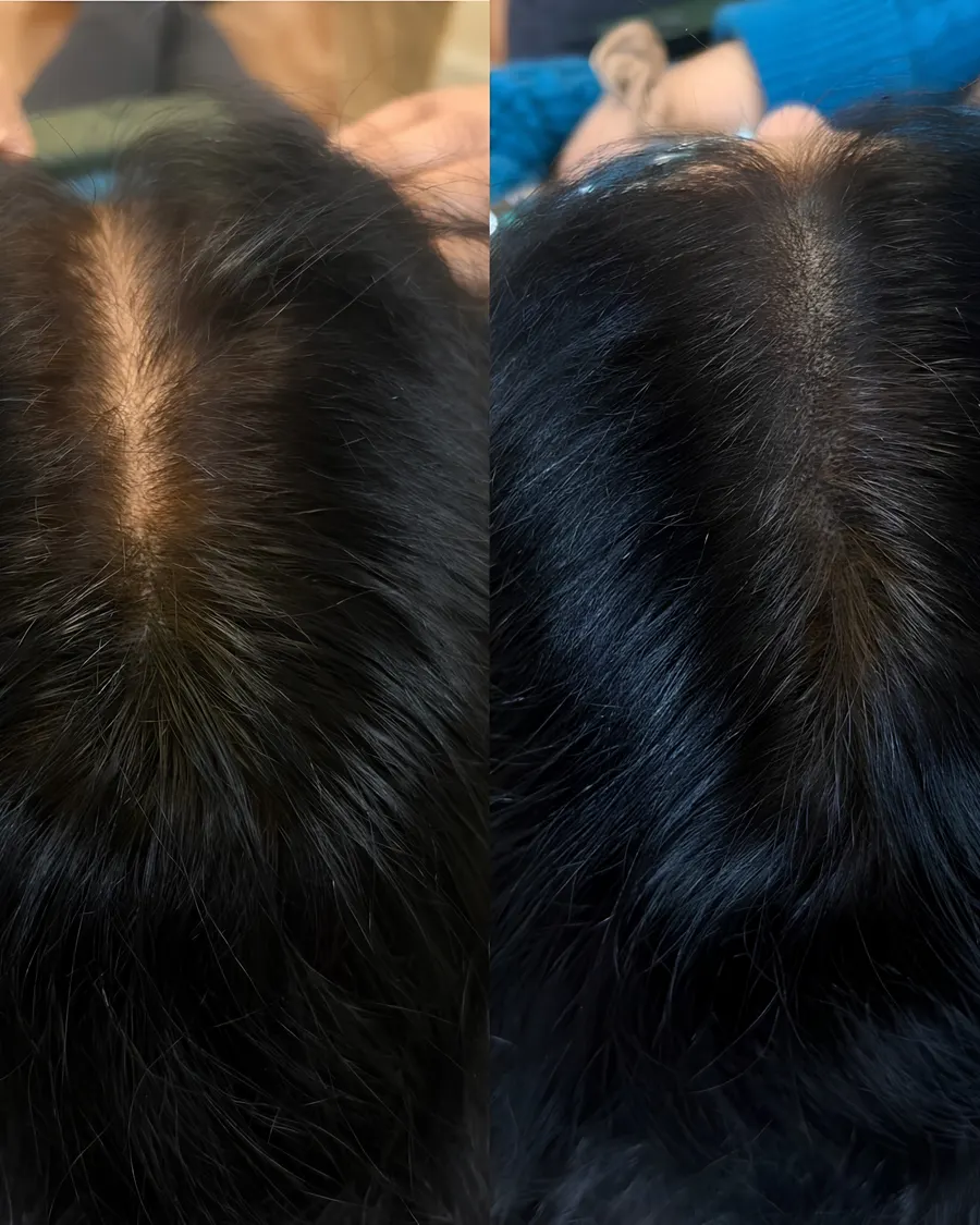 Advanced Hair Appearance Enhancement at Cinch Clinics